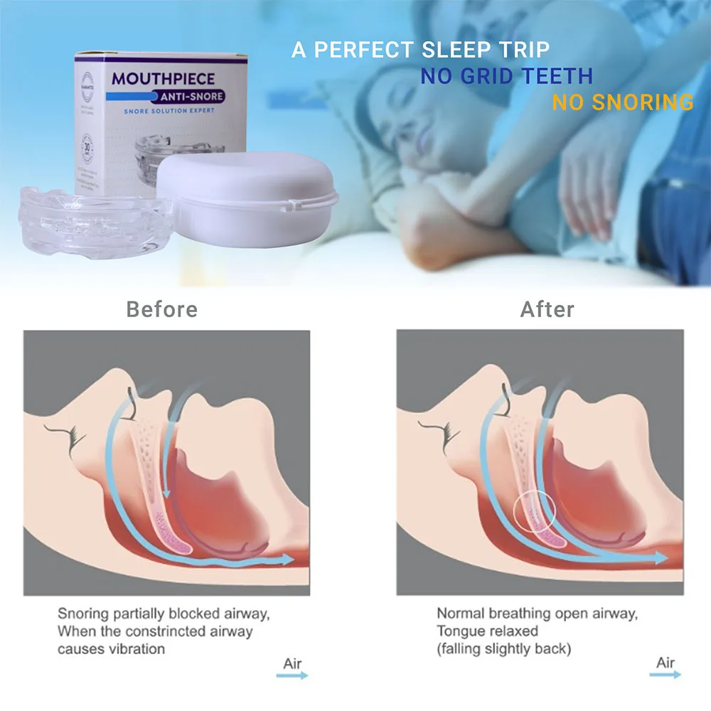 Anti Snore Solution - Image 6