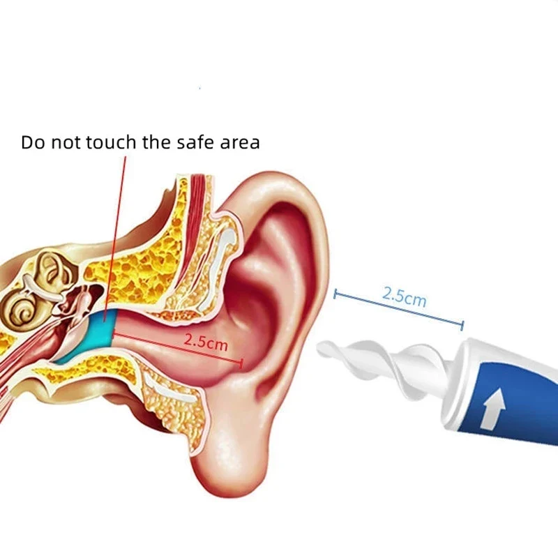 Spiral Earwax Cleaner - Image 8