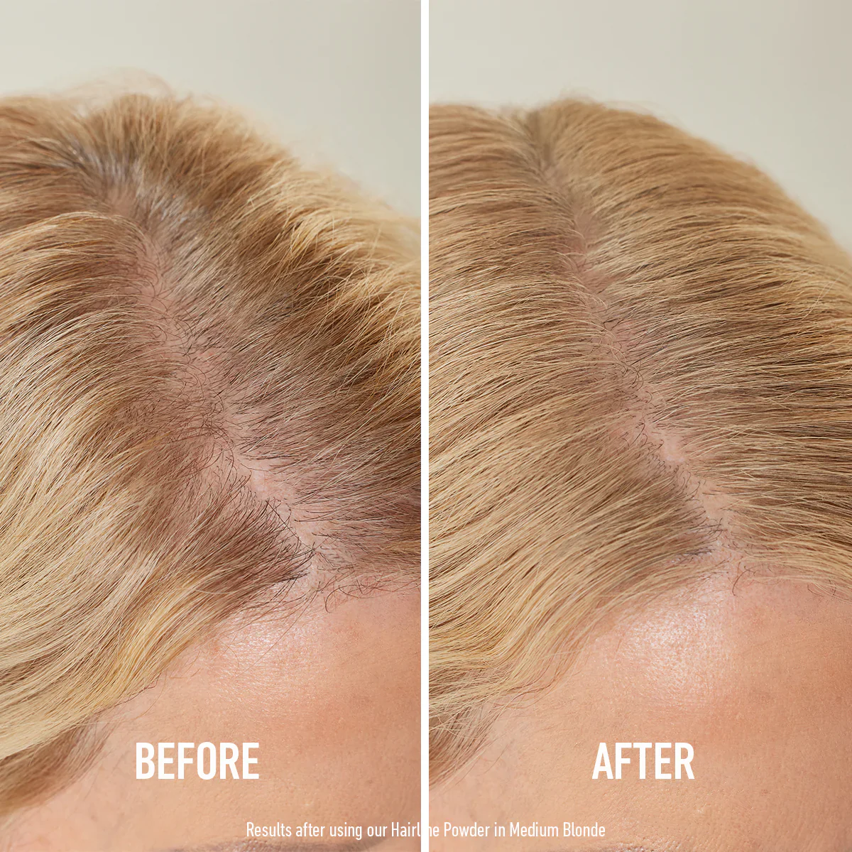 Hairline Powder™ - Image 4