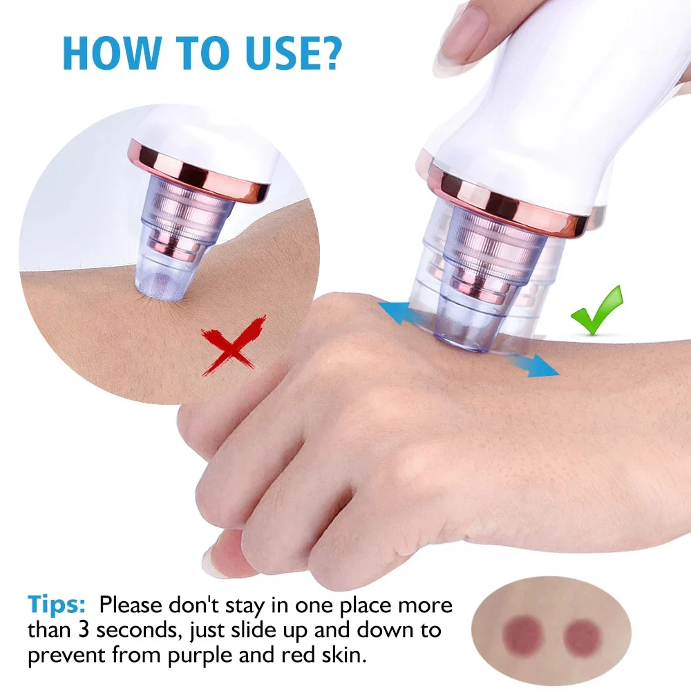 Pore Vacuum - Image 3