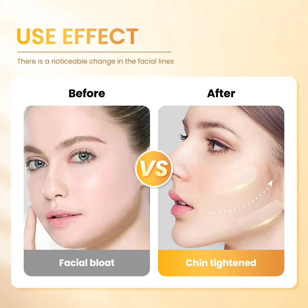 V Face Slimming Mask – Chin & Cheek Lift Up Bandage - Image 2